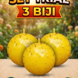 SET TRIAL